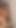 Total Nylon Encasement Part 1