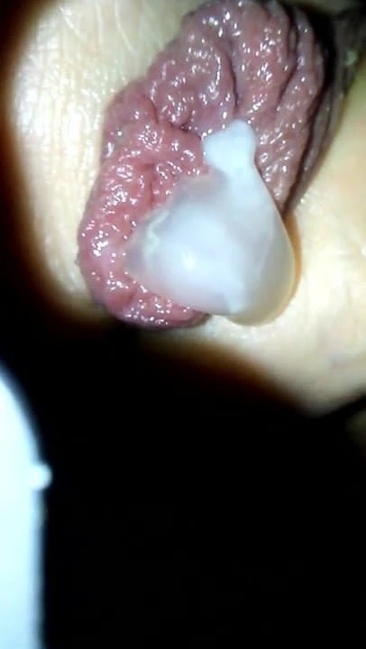Take the skin and peel it back...