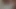 Lizzy Yum VR MAY 2023 JUST ME #2 post op orgasm pussy anal masturbation teasing orgasm