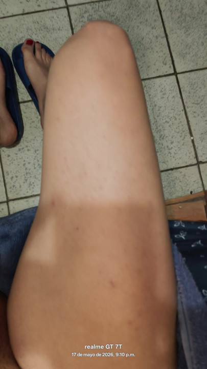 After the waxing session with cream