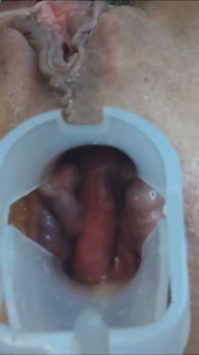 Anal speculum and pussy play wet orgasms close up | Clip 2