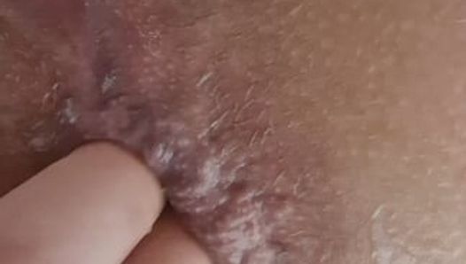 Anal dilation at home