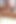Share Wife with Friend. Wife Sucks Friend. Mfm. Threesome. Cuckold. Sexual Nurse Help to Donate Sperm for Two Patients. Ep 1870