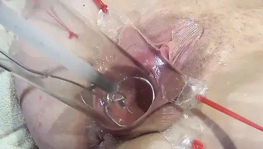 10 Weit Gespreizte Muschi Nahaufnahme Fickt Mit Lampe 1000 Watt