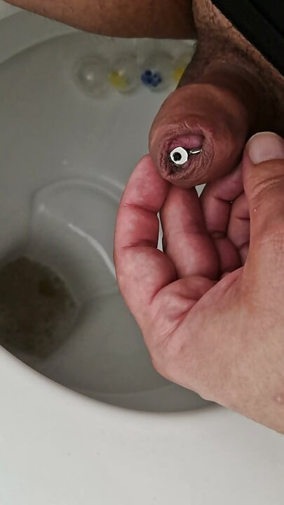 拡張器で膀胱を空にする