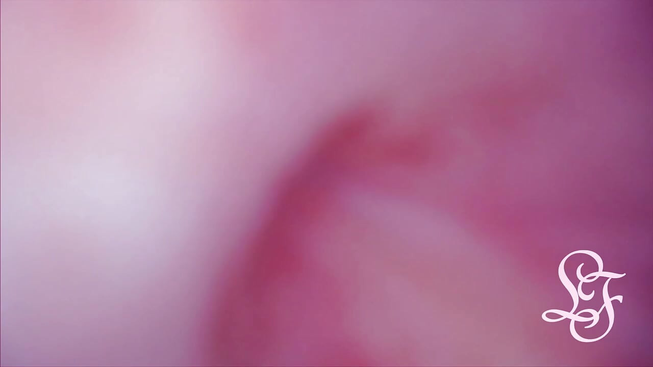 בליטה בתוך שלפוחית השתן שלי מהאנאל