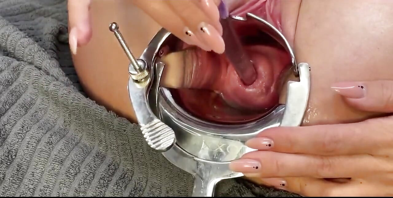 Two Toothbrushes in Cervix