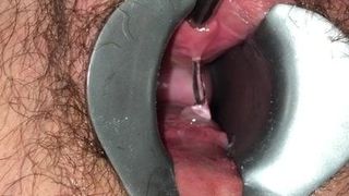 Urethraal 10 mm