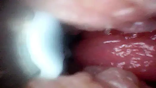 Extreme Nähe macht den Beobachter zu einem aktiven, hungrigen teilnehmer