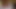 彼女の日焼けはどう思う?