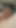 Cock cage cum