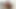 成熟したGyno - 裸の女性患者のGyno病院ビデオ