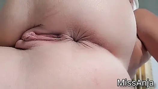 Tease