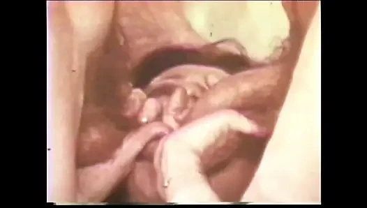 İştah açıcı emme