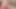 Old hairy ugly granny wants sex in nylons