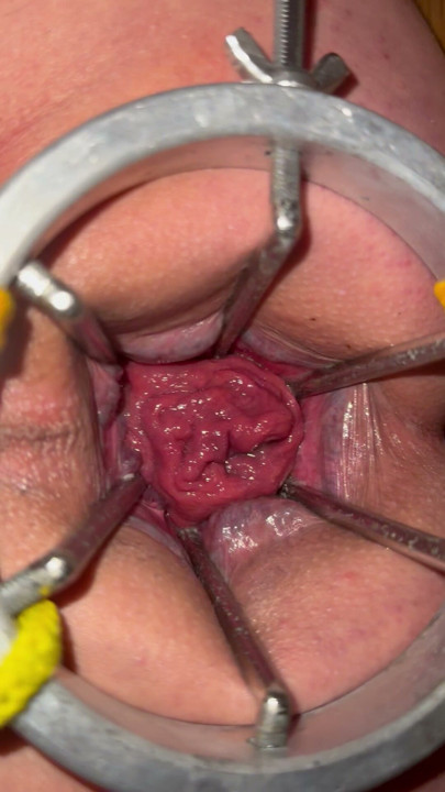 Anal expander fully open showing off rose