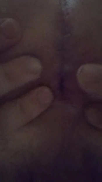 My ass hole