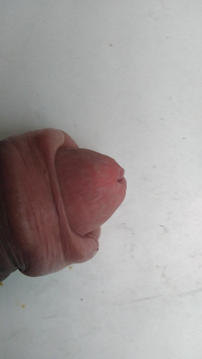 Umpdicu