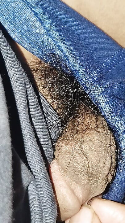 Acne on my penis I want to clean it up