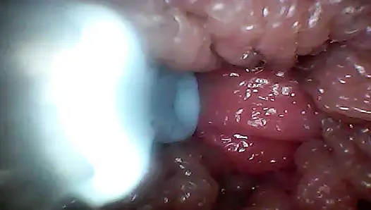 Kedekatan ekstrem mengubah watcher menjadi aktif, peserta yang lapar