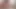 Lizzy Yum - Just Dilating #3 Post-op Orgasm Pussy Clit Masturbation Teasing Orgasm