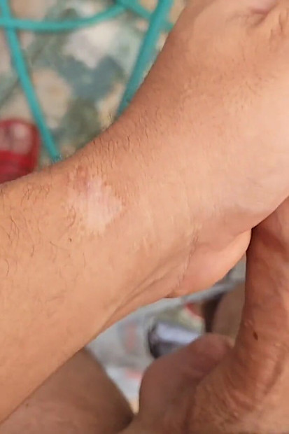 Trenutni rast s vrtnim crijevom