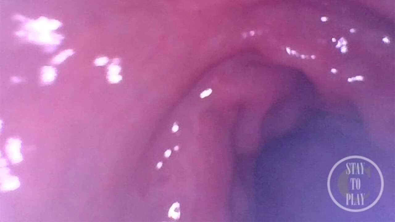 Exploring the Depths of my Ass with the Minicam!