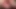 extreme anal fisting casting teen