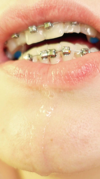 Spectacular moment from "braces mouth tour video - vore fetish"