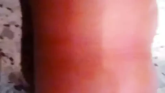 Jens11 forskin