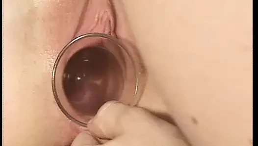 Hot German sluts getting asses fucked hard in the hospotal
