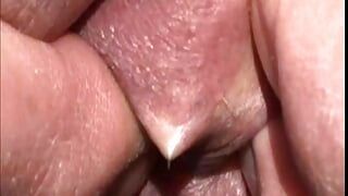 Close-Up Sack Piercing