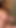 Heiße reife MILF mit massivem busch