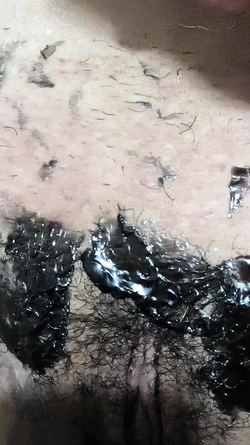 Waxing memek dengan lilin panas 🥵