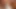 VISIT-X Redhead hat kein Loch mehr im Vierer FMMM frei