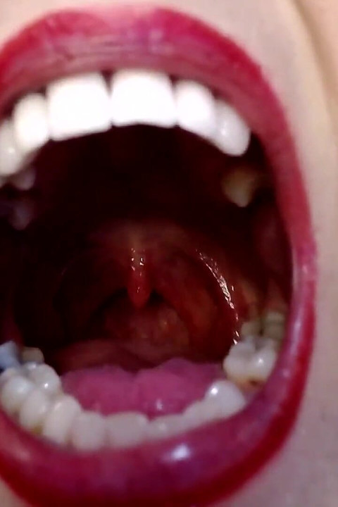 Big Wide Inside Both Girls Mouths