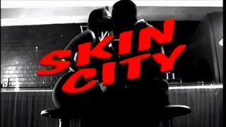 Skin City