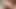 There is a big vein in the middle of my cock