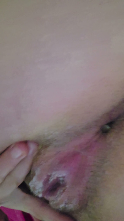 Close-up of a bottle inserted into the anus... | Clip 2