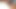 継母のきつい秘部に印がついている
