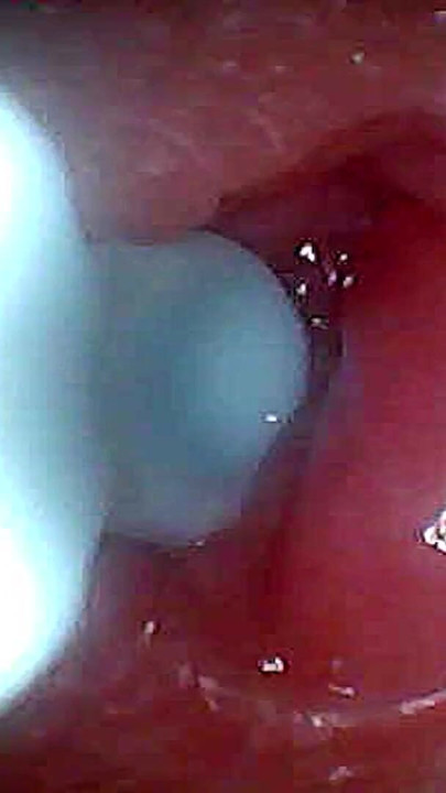 I couldn’t believe what happens INSIDE the penis as sperm passes through (endoscopic footage) | Clip 1