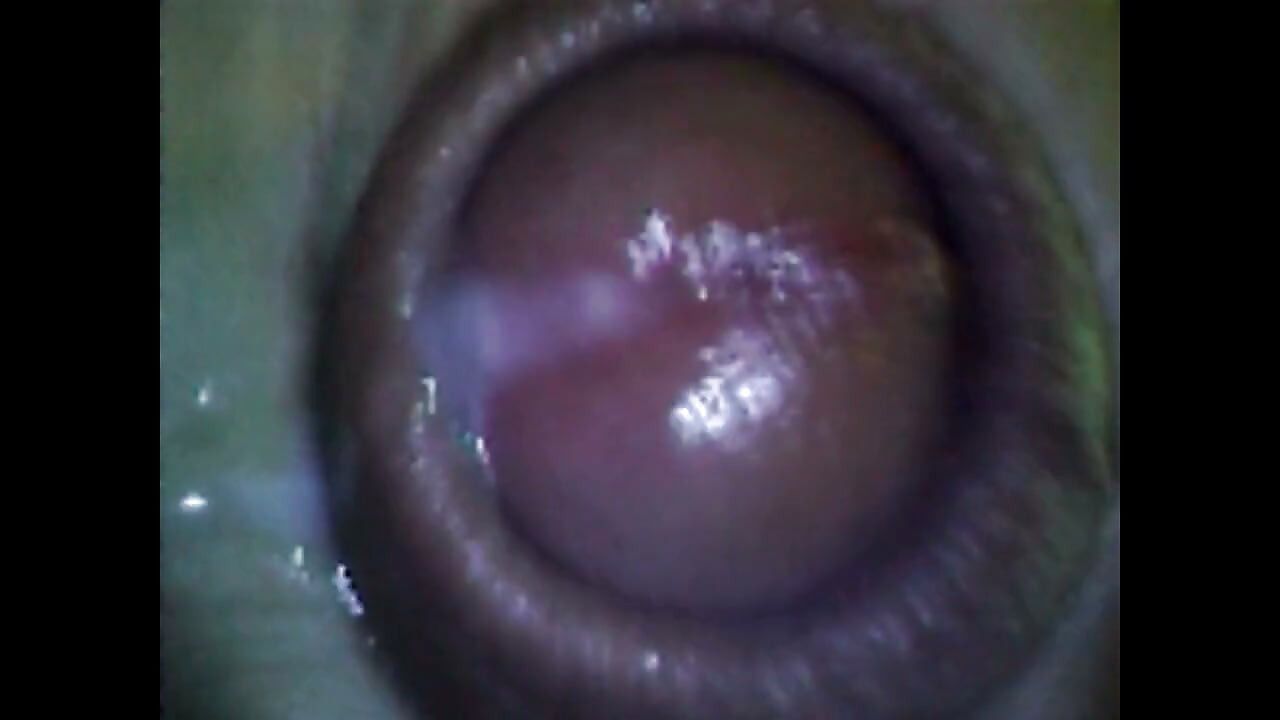 Endoscope Details - Hole Balls Cock Foreskin Belly Nipples Mouth Sperm