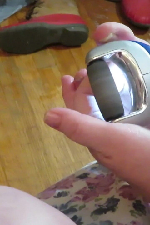 Pielęgniarka Vicki miele paznokcie u nóg za pomocą elektrycznego narzędzia do jaj Pedi! Biedne brzydkie palce potrzebują tego naprawdę źle!