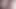 Masturbation Anal