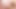Two naked students - Nipple stickers - pained removing. Czech fetish porn