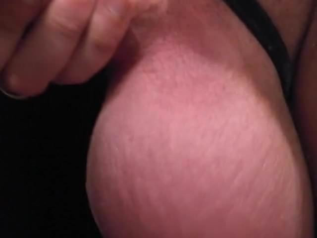 MASSIVE FORESKIN -  SALINED BALLS