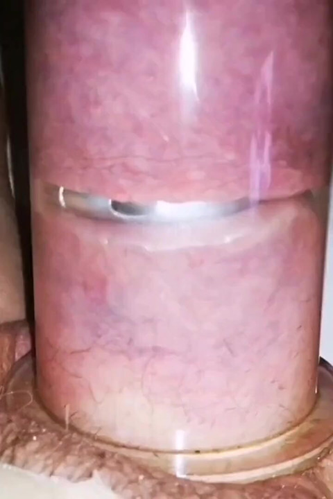 The Meat Is Eating It