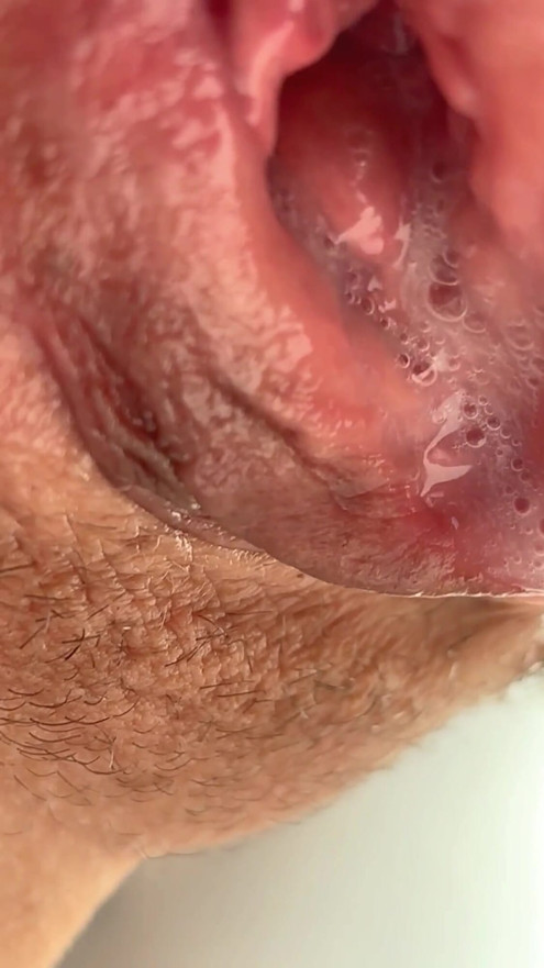 Âm hộ há hốc mồm