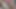 Mega swollen hairy cunt cums from hitachi vibrator