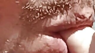 Sexy mouth complication